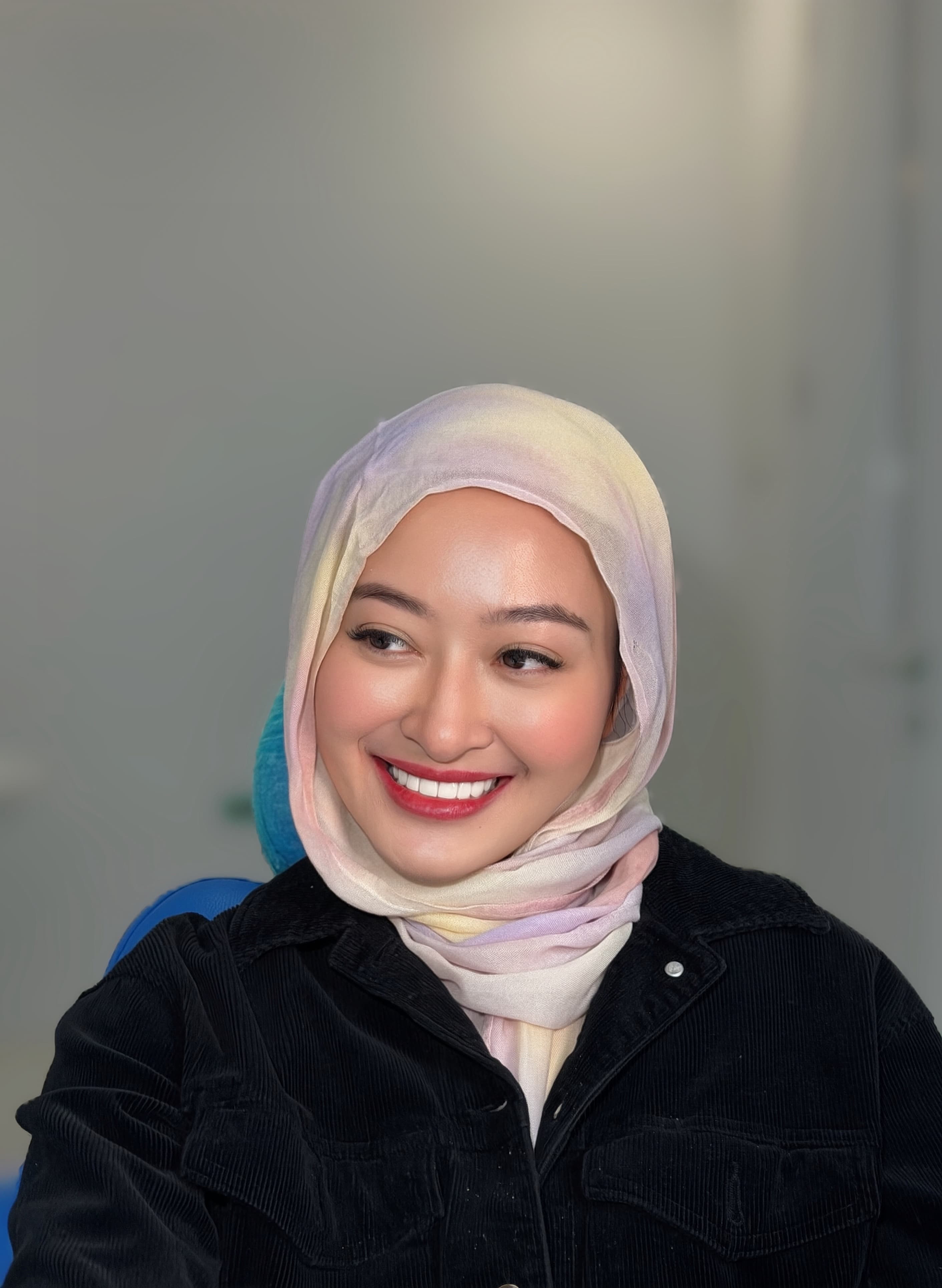 Smile result — Porcelain Veneer by Putri Modiyanti