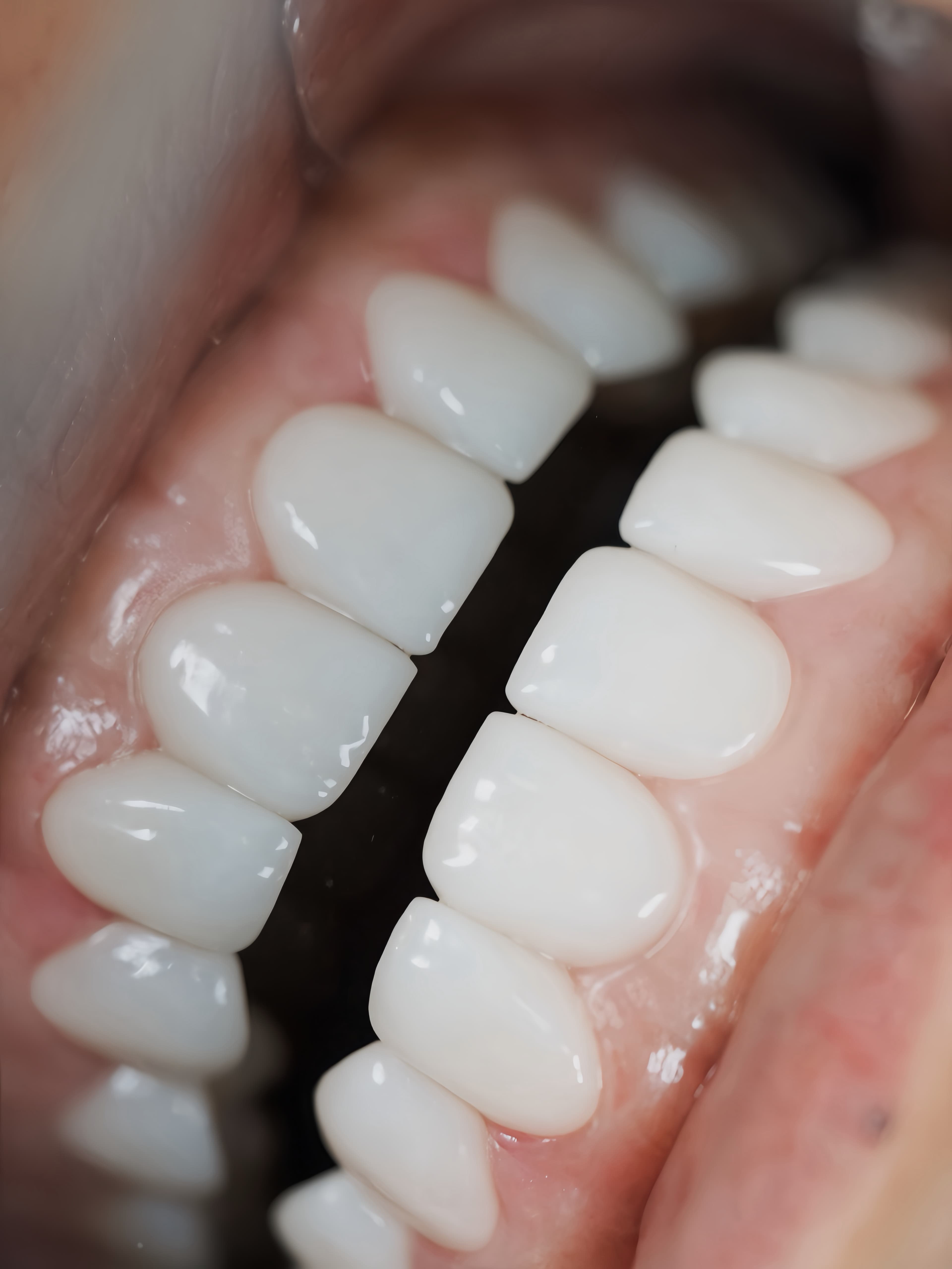 Top-notch Dental Services